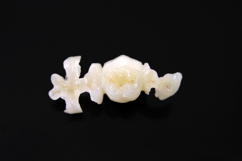 コンポジットレジン